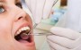 Governo quer incentivar atendimento odontológico nas universidades